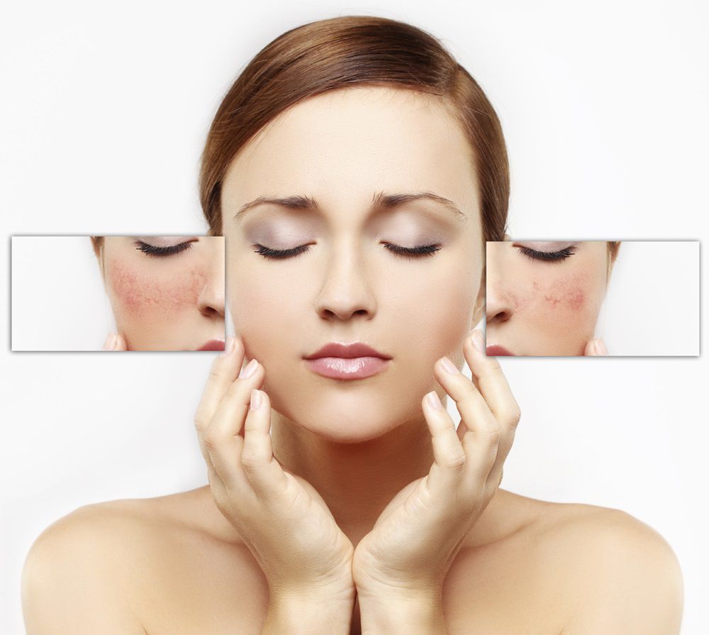 Điều trị da tổn thương
